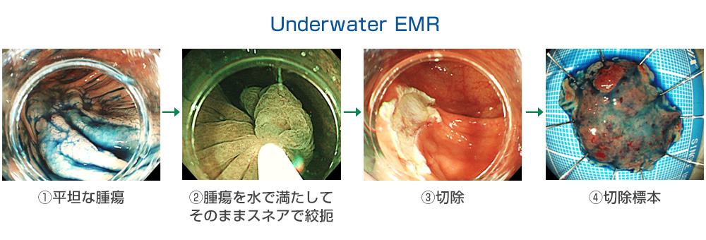 Underwater EMR